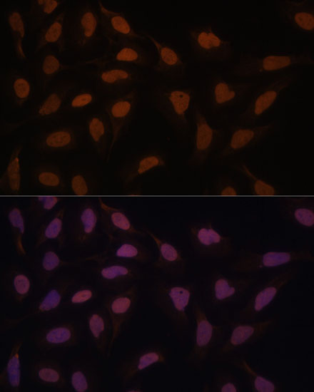 FCF1 Rabbit Polyclonal Antibody - Image 4