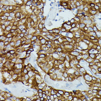 FCGR1B Rabbit Polyclonal Antibody - Image 2