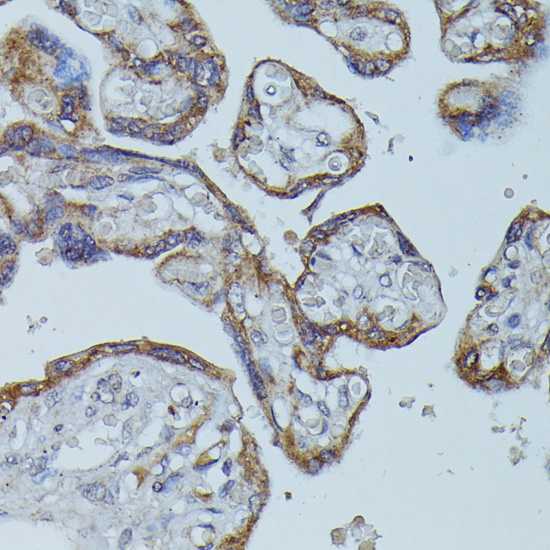 FCGR1B Rabbit Polyclonal Antibody - Image 3