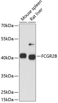 FCGR2B Rabbit Polyclonal Antibody