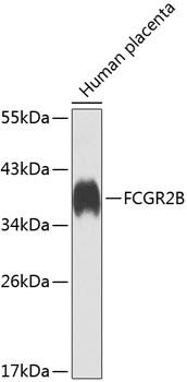 FCGR2B Rabbit Polyclonal Antibody