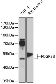 FCGR3B Rabbit Polyclonal Antibody
