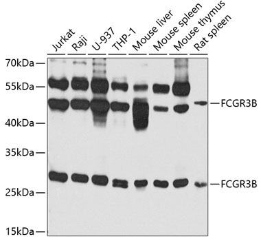 FCGR3B Rabbit Polyclonal Antibody