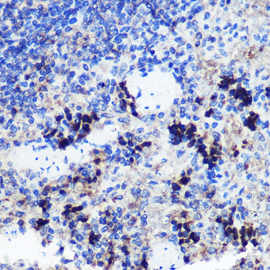 FCHSD1 Rabbit Polyclonal Antibody - Image 2