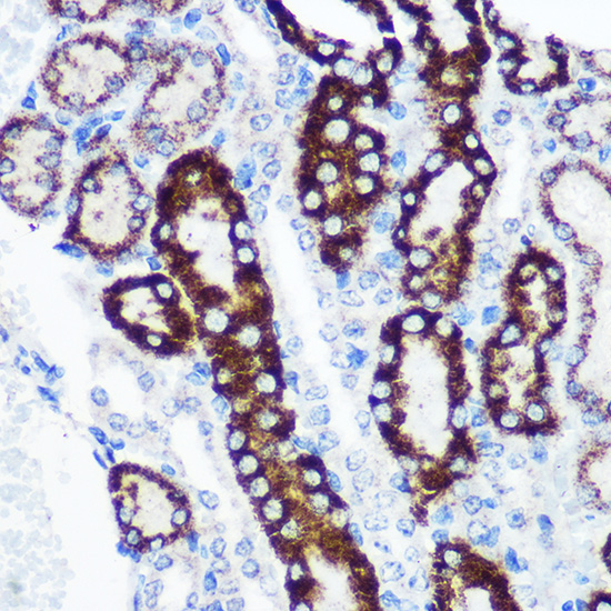 FCHSD1 Rabbit Polyclonal Antibody - Image 3