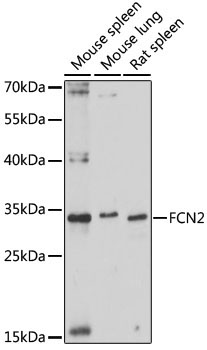 FCN2 Rabbit Polyclonal Antibody