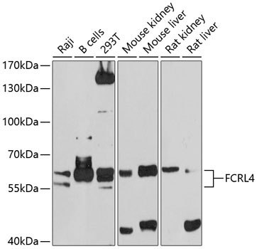 FCRL4 Rabbit Polyclonal Antibody