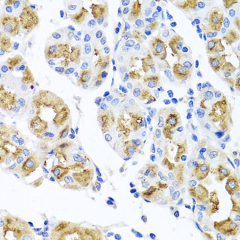 FECH Rabbit Polyclonal Antibody - Image 2