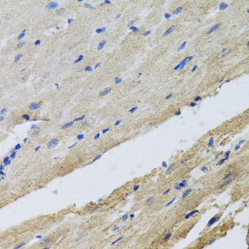 FECH Rabbit Polyclonal Antibody - Image 3