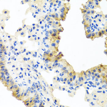 FECH Rabbit Polyclonal Antibody - Image 4