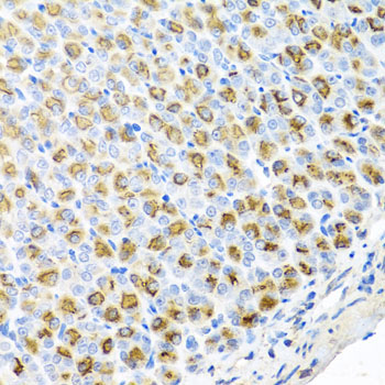 FECH Rabbit Polyclonal Antibody - Image 5