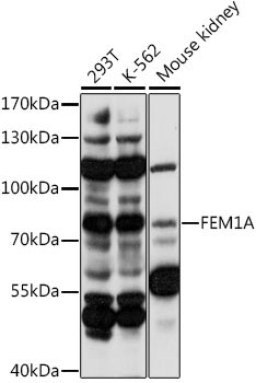 FEM1A Rabbit Polyclonal Antibody