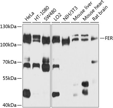 FER Rabbit Polyclonal Antibody