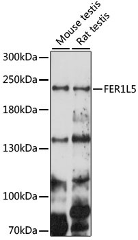 FER1L5 Rabbit Polyclonal Antibody