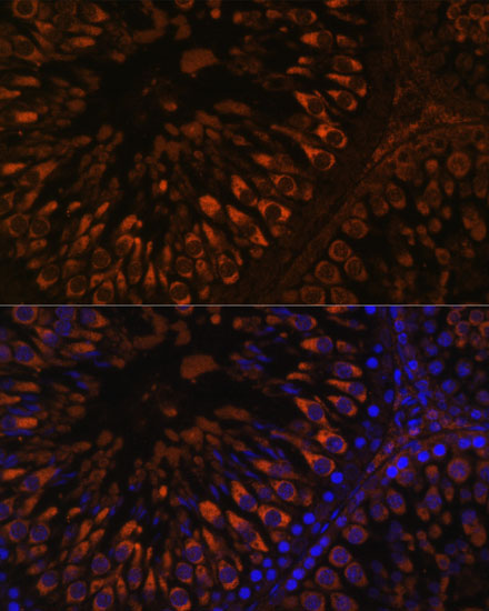 FER1L5 Rabbit Polyclonal Antibody - Image 2