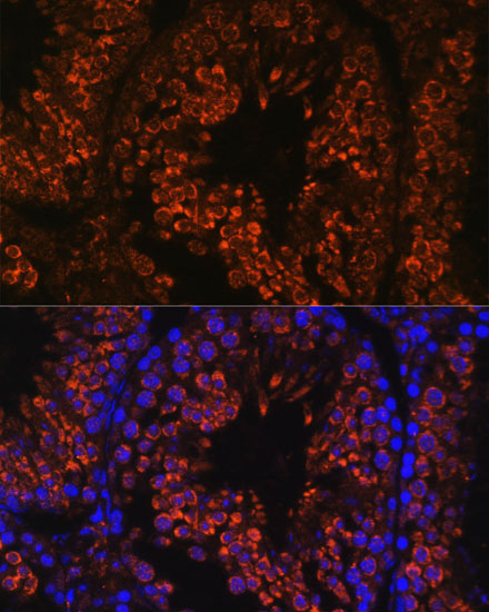 FER1L5 Rabbit Polyclonal Antibody - Image 3
