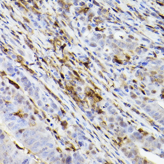 Ferritin Heavy Chain Rabbit Monoclonal Antibody