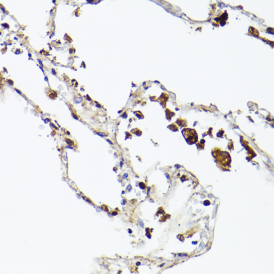 Ferritin Heavy Chain Rabbit Monoclonal Antibody - Image 2