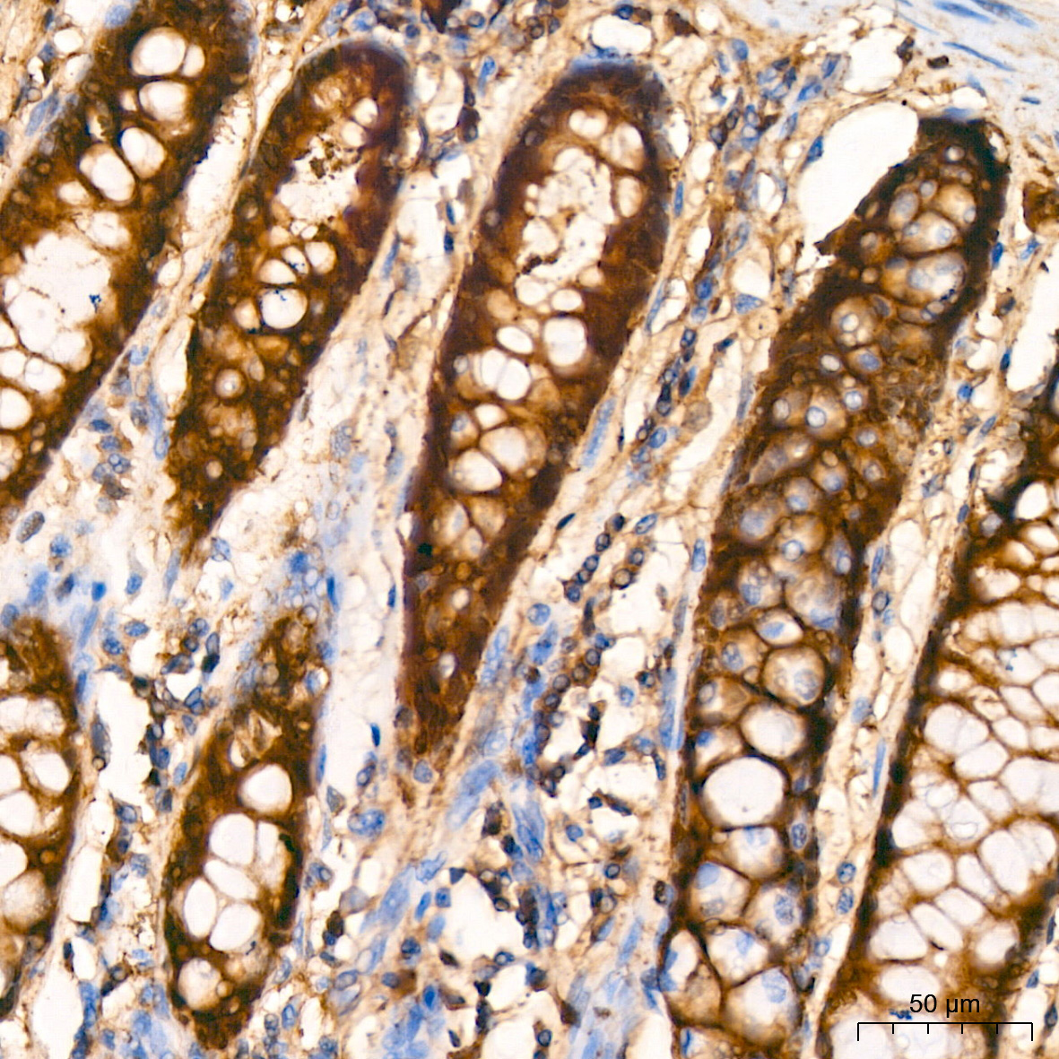 Ferritin Heavy Chain Rabbit Monoclonal Antibody - Image 3