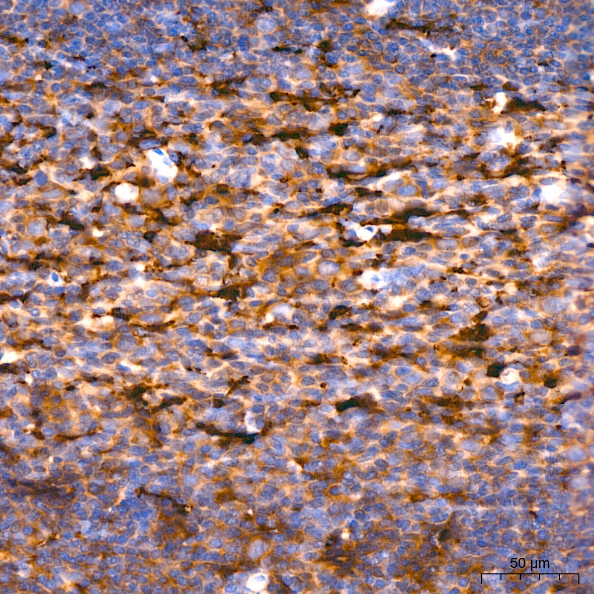 Ferritin Heavy Chain Rabbit Monoclonal Antibody - Image 4