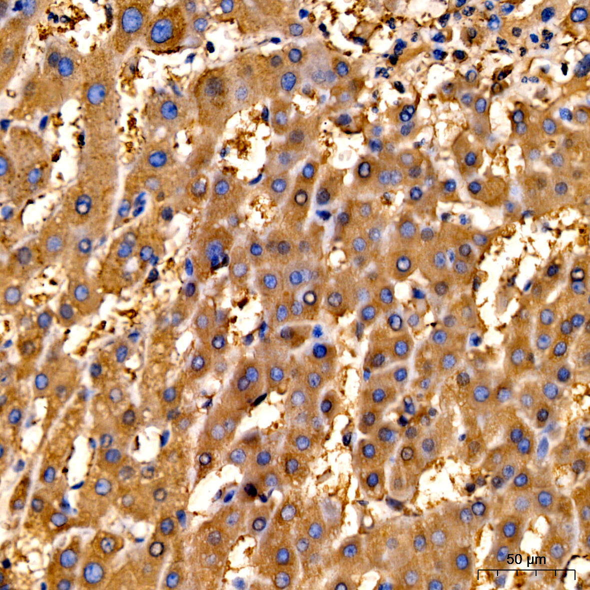 Ferritin Heavy Chain Rabbit Polyclonal Antibody - Image 2