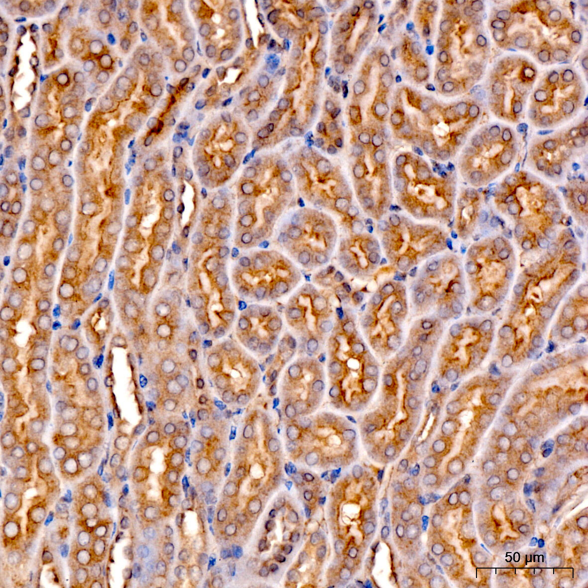 Ferritin Heavy Chain Rabbit Polyclonal Antibody - Image 3
