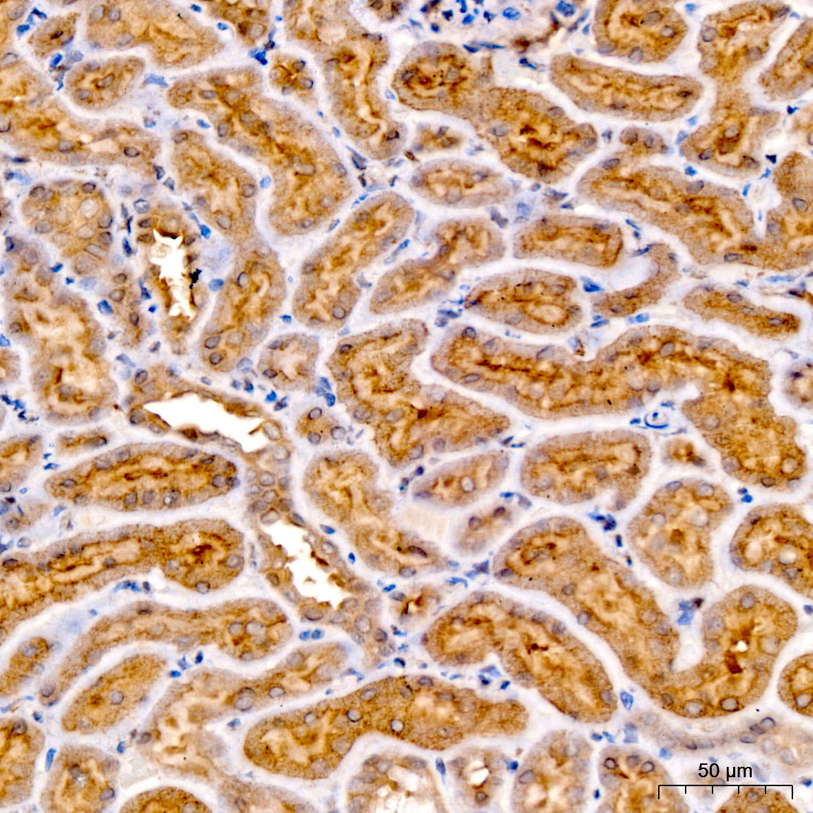 Ferritin Heavy Chain Rabbit Polyclonal Antibody - Image 4