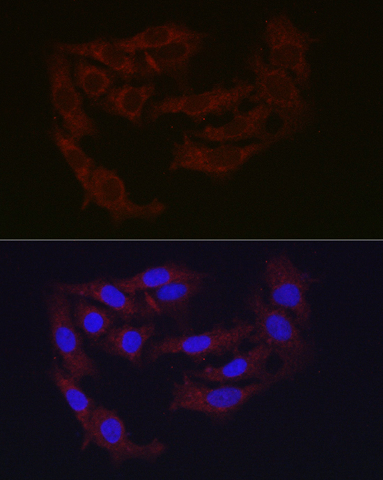 Ferritin Heavy Chain Rabbit Polyclonal Antibody - Image 5