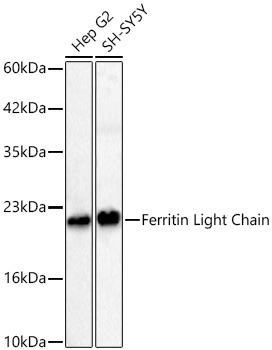 Ferritin Light Chain Rabbit Monoclonal Antibody - Image 2