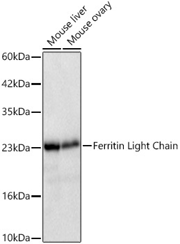 Ferritin Light Chain Rabbit Monoclonal Antibody - Image 3