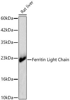 Ferritin Light Chain Rabbit Monoclonal Antibody - Image 4