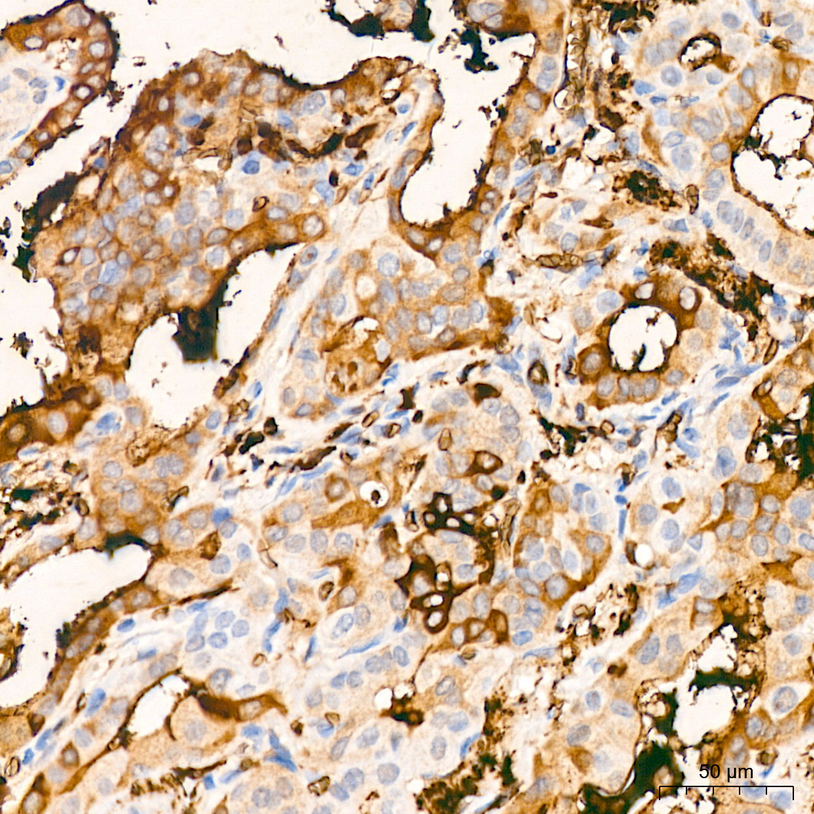 Ferritin Light Chain Rabbit Monoclonal Antibody - Image 5
