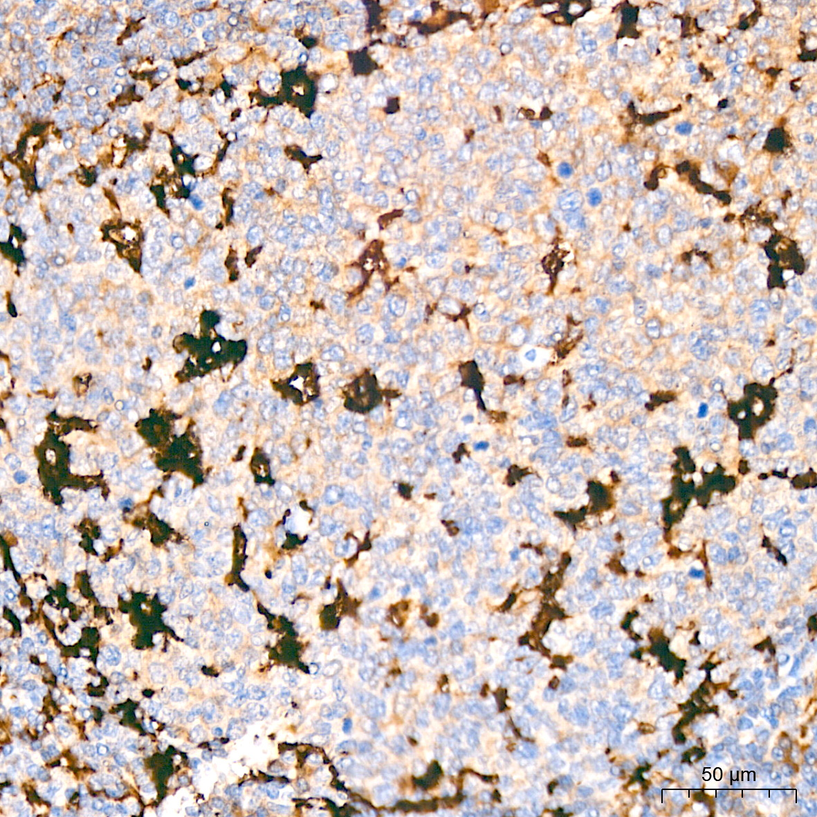 Ferritin Light Chain Rabbit Monoclonal Antibody - Image 6