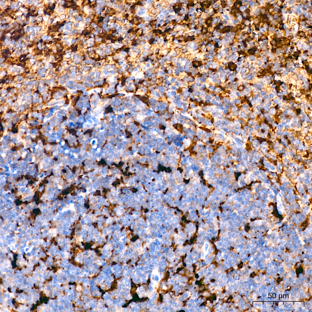 Ferritin Light Chain Rabbit Monoclonal Antibody - Image 7