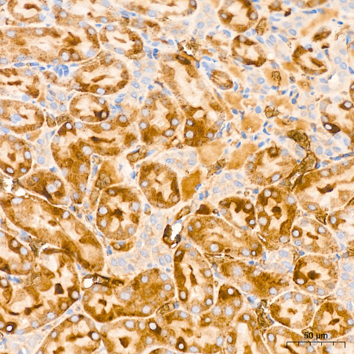 Ferritin Light Chain Rabbit Monoclonal Antibody - Image 8