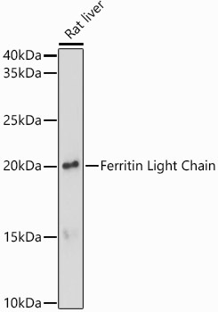 Ferritin Light Chain Rabbit Polyclonal Antibody - Image 2