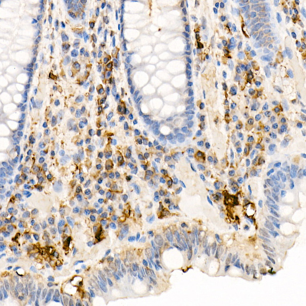 Ferritin Light Chain Rabbit Polyclonal Antibody - Image 3