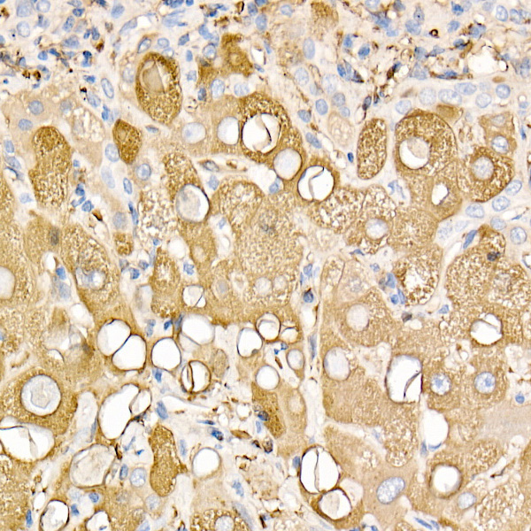 Ferritin Light Chain Rabbit Polyclonal Antibody - Image 4
