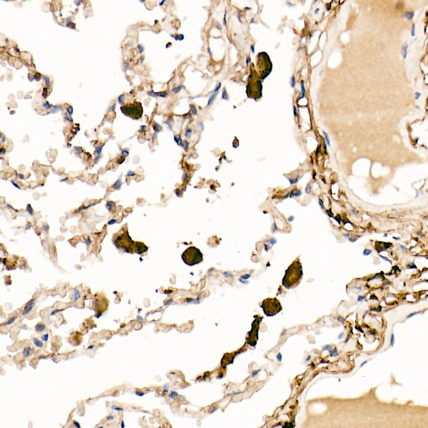 Ferritin Light Chain Rabbit Polyclonal Antibody - Image 5