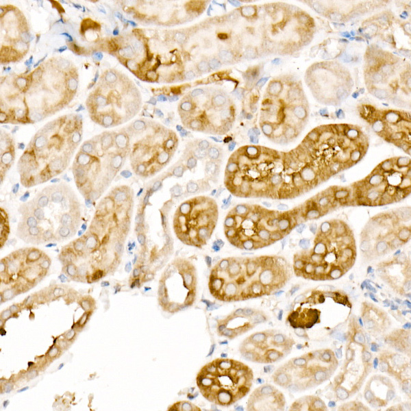 Ferritin Light Chain Rabbit Polyclonal Antibody - Image 6