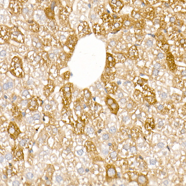 Ferritin Light Chain Rabbit Polyclonal Antibody - Image 7