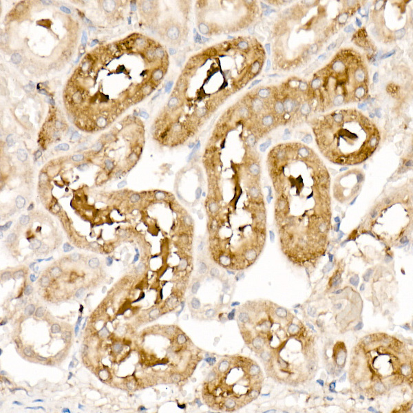Ferritin Light Chain Rabbit Polyclonal Antibody - Image 8