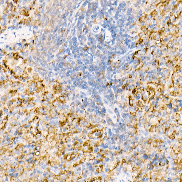 Ferritin Light Chain Rabbit Polyclonal Antibody - Image 9