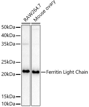 Ferritin Light Chain Rabbit Polyclonal Antibody