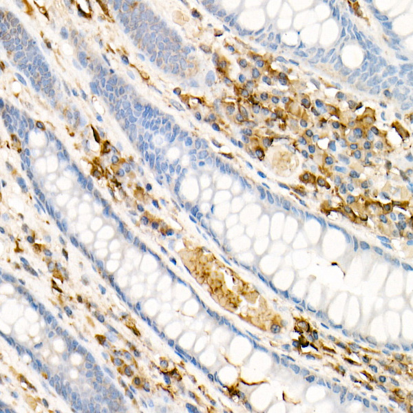 Ferritin Light Chain Rabbit Polyclonal Antibody - Image 2