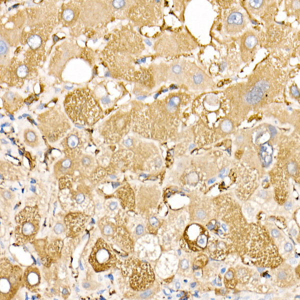 Ferritin Light Chain Rabbit Polyclonal Antibody - Image 3