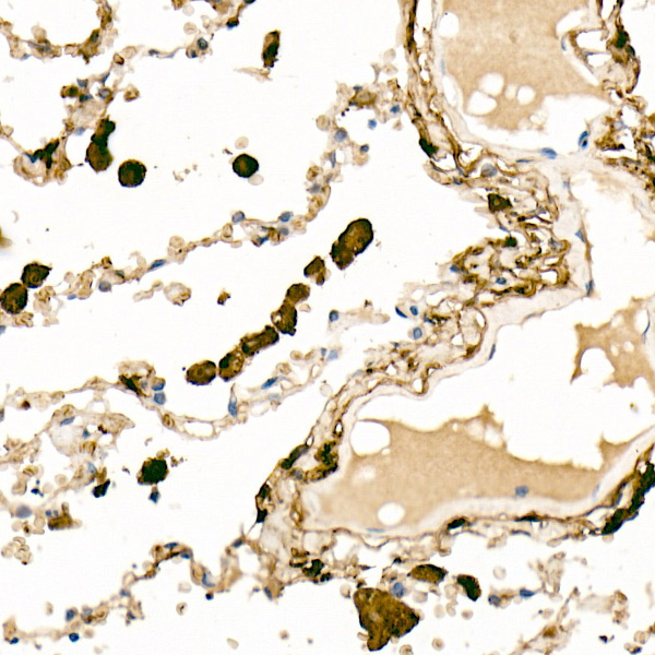 Ferritin Light Chain Rabbit Polyclonal Antibody - Image 4