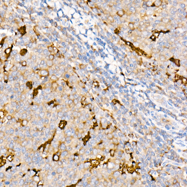 Ferritin Light Chain Rabbit Polyclonal Antibody - Image 5