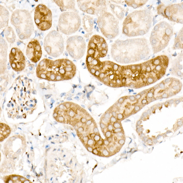 Ferritin Light Chain Rabbit Polyclonal Antibody - Image 6