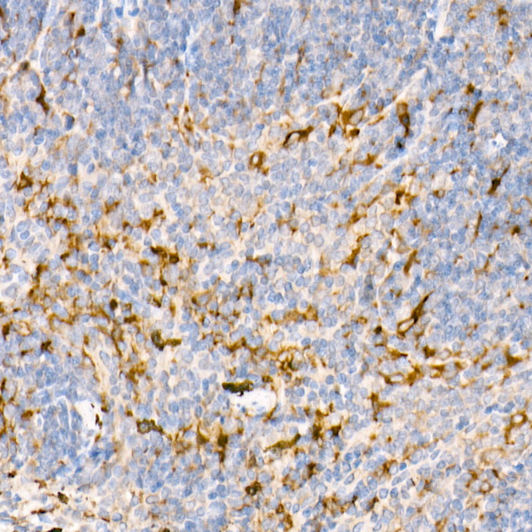 Ferritin Light Chain Rabbit Polyclonal Antibody - Image 7